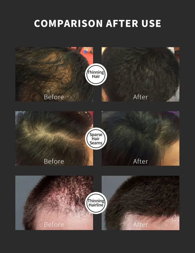 Natural hair-dense fibers