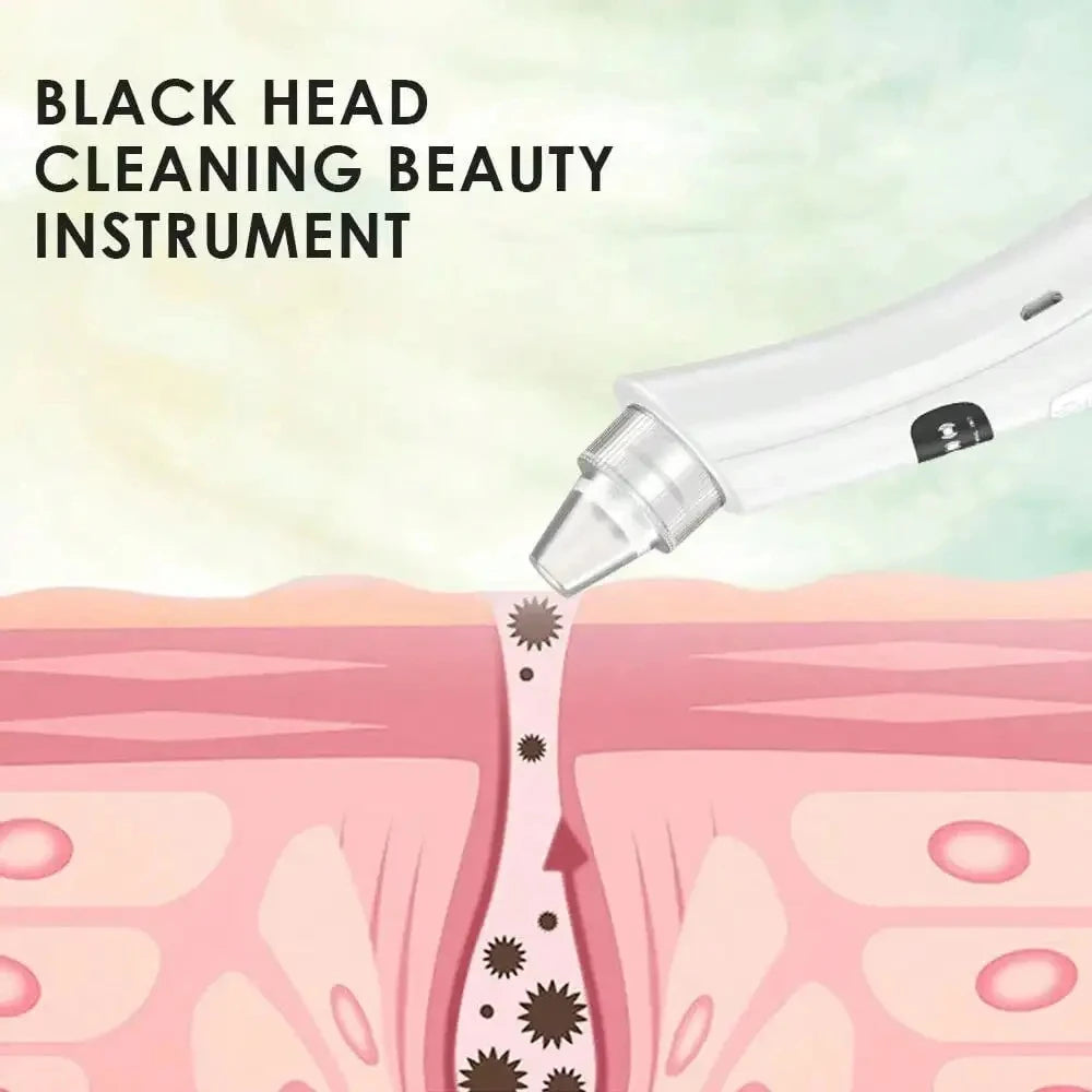 3-Suction Mode Vacuum Pore Cleaner